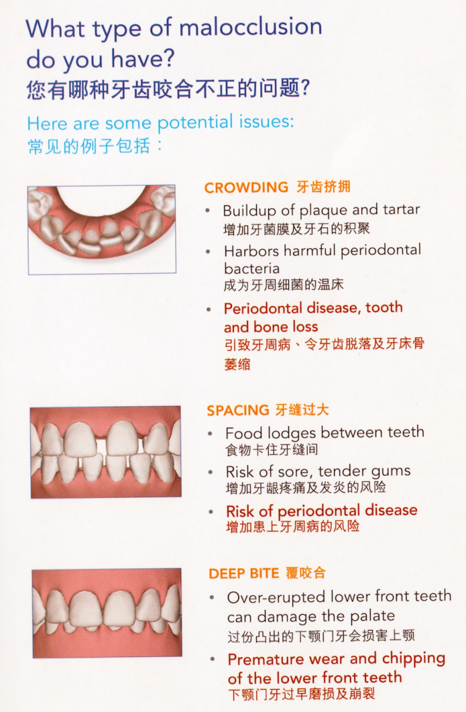 type-malocclusion