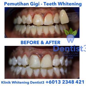 klinik-whitening-dentist3