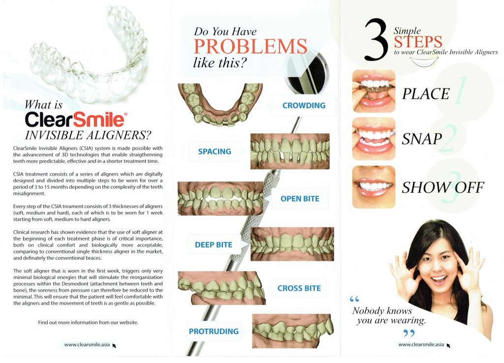 clear aligner , invisible braces