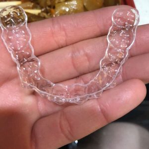 see through aligners