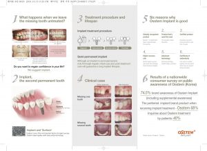 dental-tooth-implant-malaysia-2