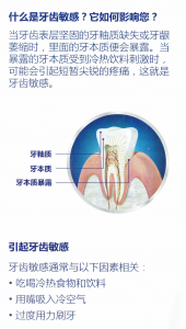 Sensitive-teeth-1
