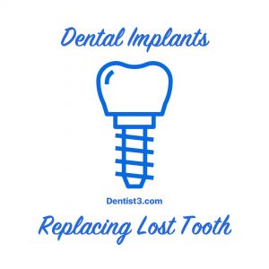 malaysia-dentist-implants