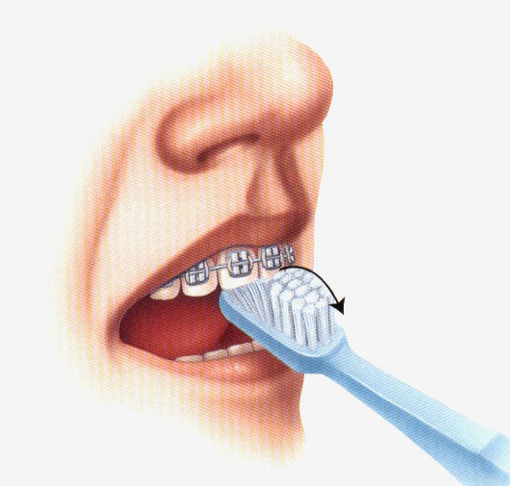 For the insides of your teeth, use the tip of your brush.
