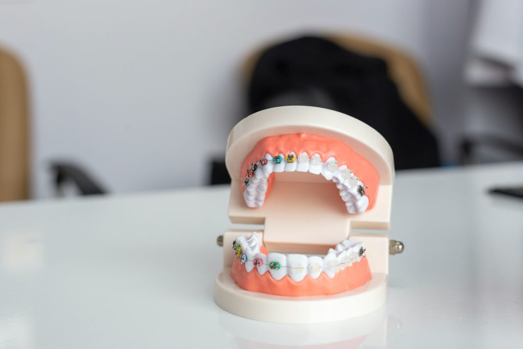 When things go wrong with braces, it can seem like an emergency. And every dentist in Malaysia is different in how they handle the problems that arise. Some see patients on weekends, others tell you to wait until Monday to come in. 