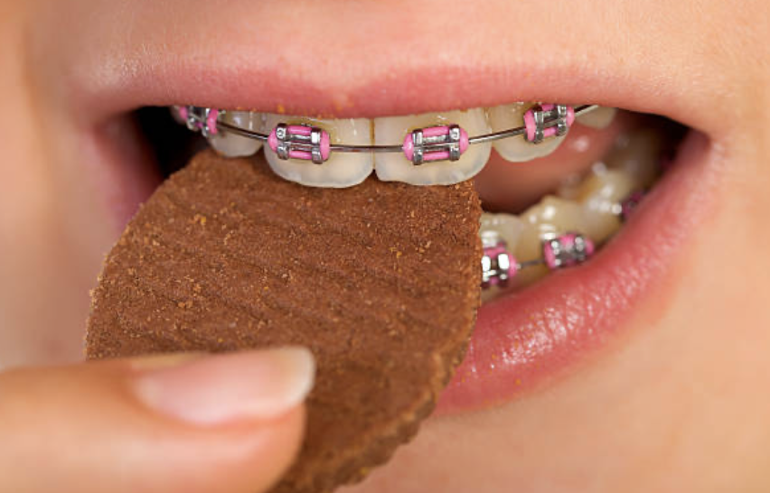 dentists recommend sticking to the classic three meals, possibly with a snack between meals