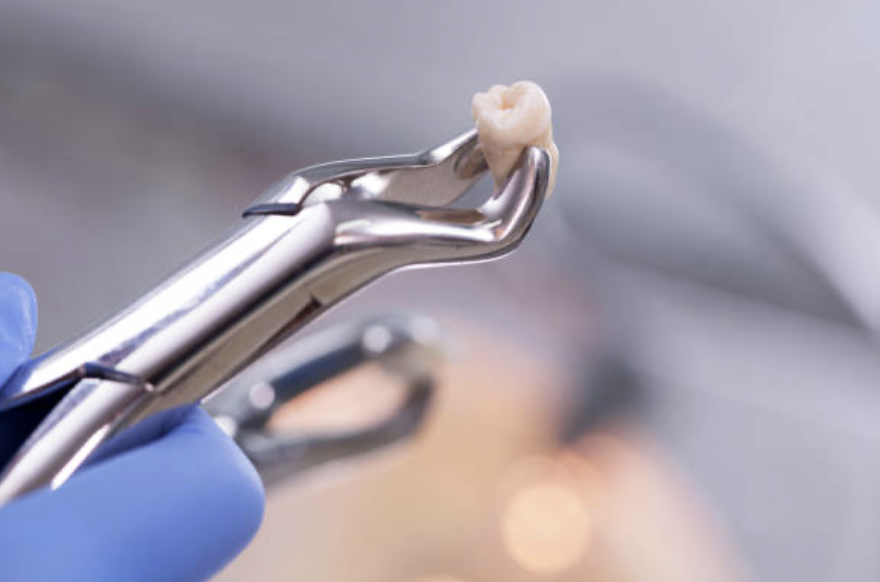 When most people think about going to the oral surgeon, they are visualising wisdom teeth being extracted.