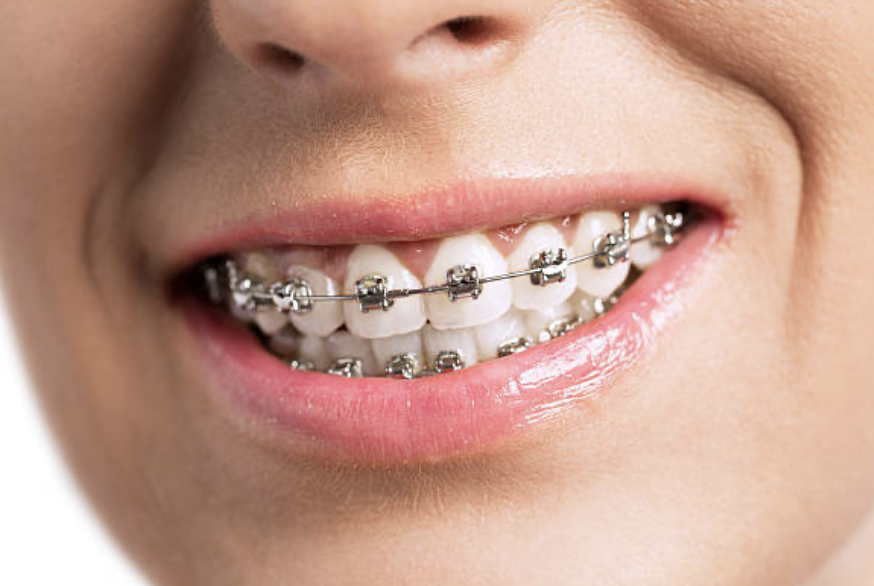 Di Klinik Pergigian Dentist3, kami suka mencipta senyuman yang indah untuk pesakit dari semua peringkat umur.
